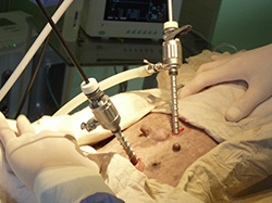 CIRURGIA LAPAROSCÒPICA